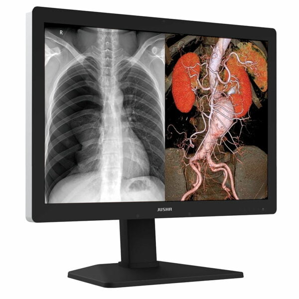 Monitor de Diagnóstico C630G