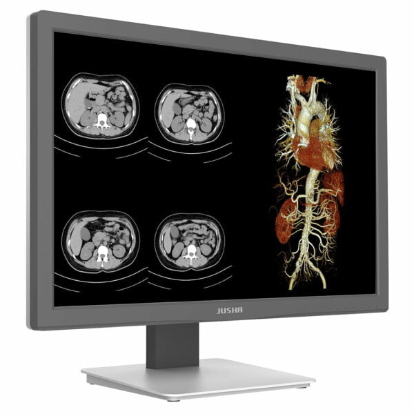 Monitor de Diagnóstico CR240G